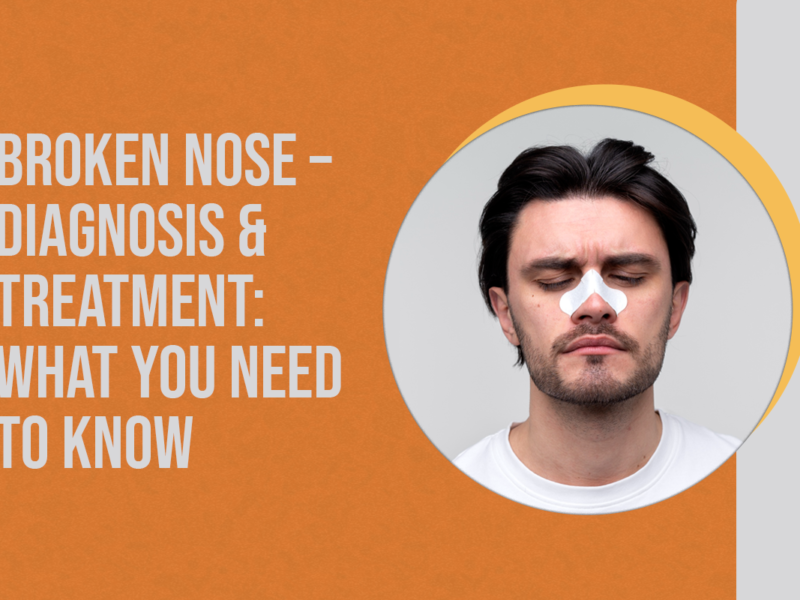 Broken Nose – Diagnosis & Treatment: What You Need to Know