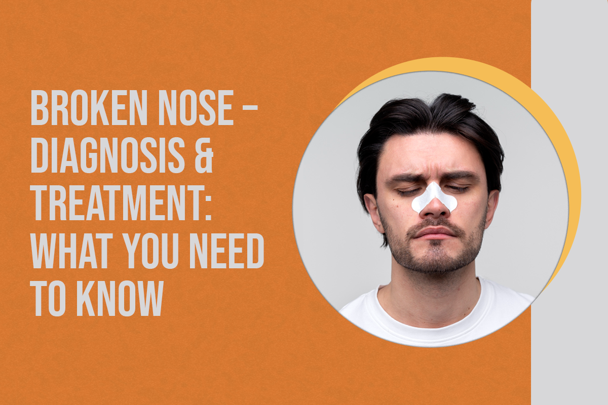 Broken Nose – Diagnosis & Treatment: What You Need to Know