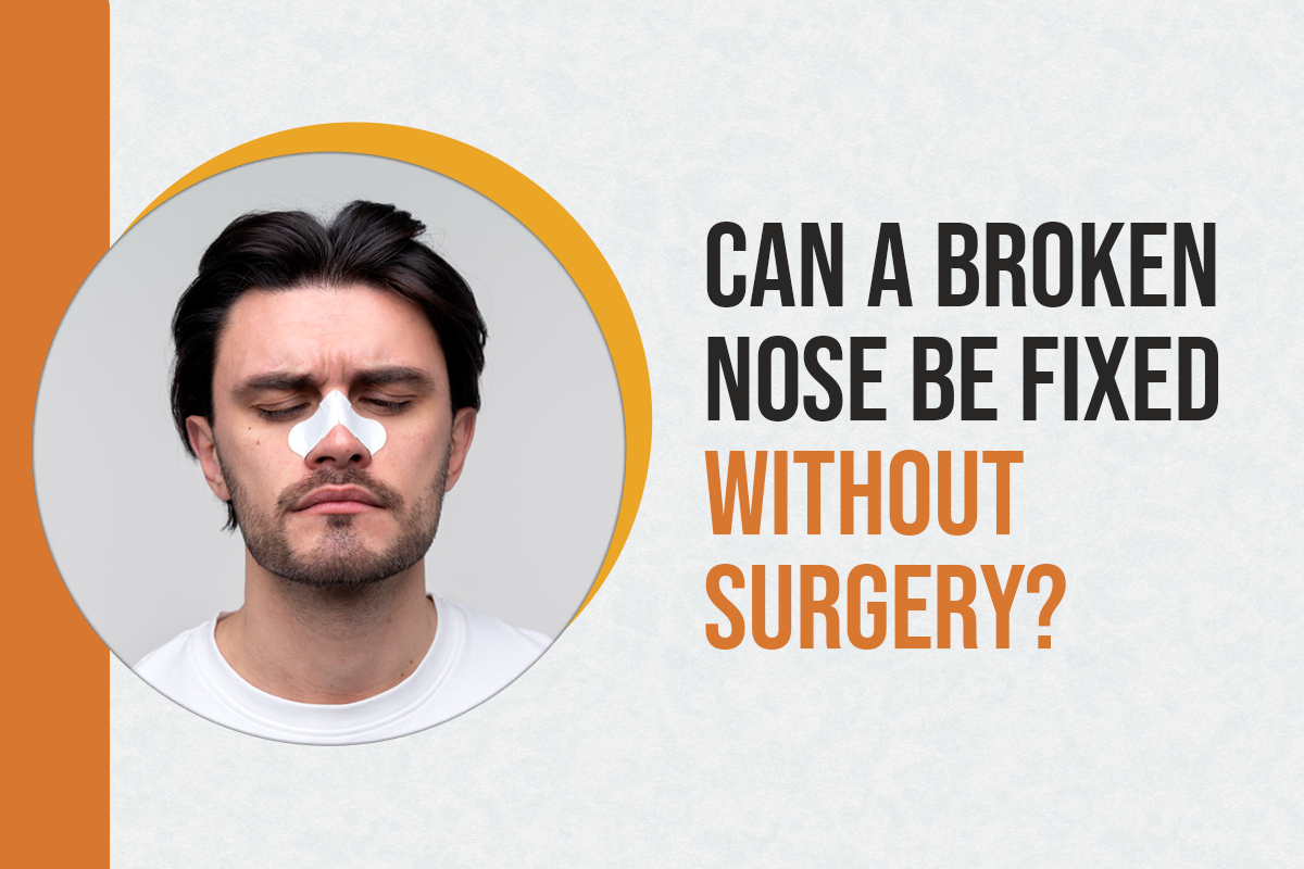 Can a Broken Nose Be Fixed Without Surgery?