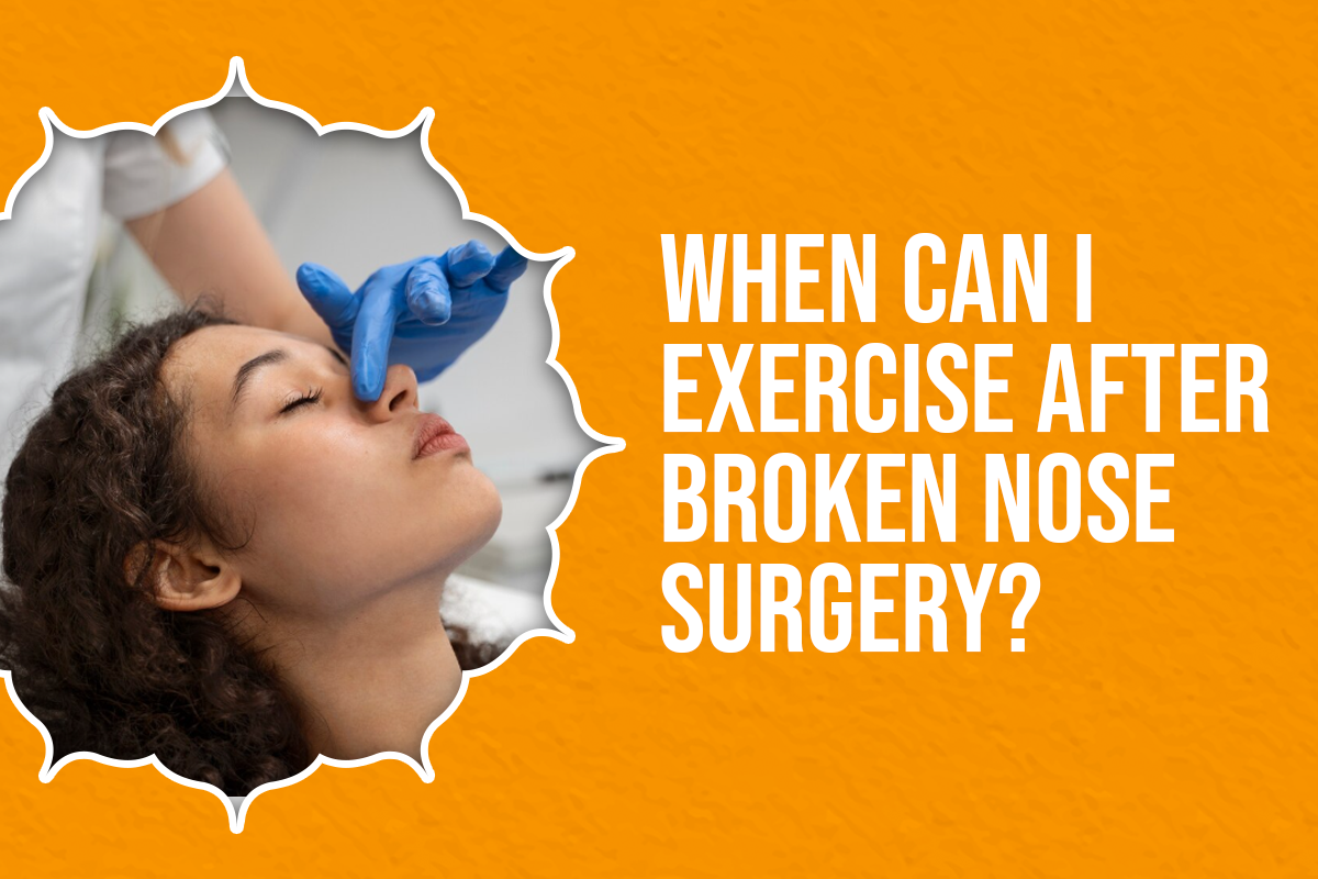 When Can I Exercise After Broken Nose Surgery?