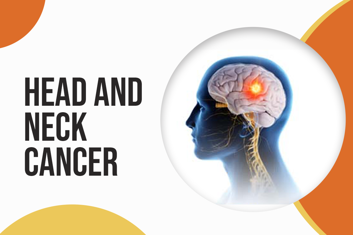 Head and Neck Cancer