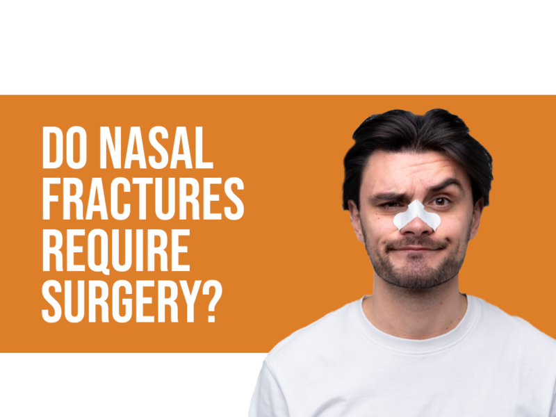 Do Nasal Fractures Require Surgery?
