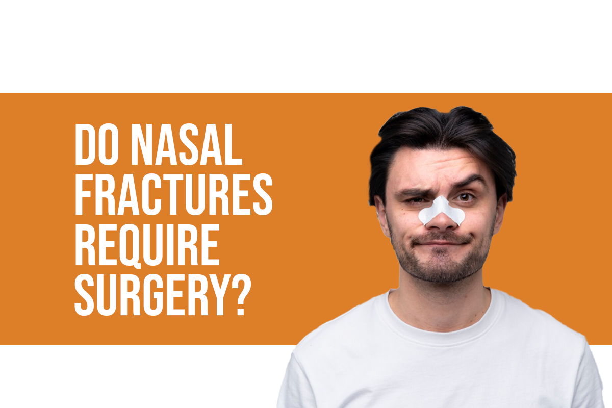 Do Nasal Fractures Require Surgery?