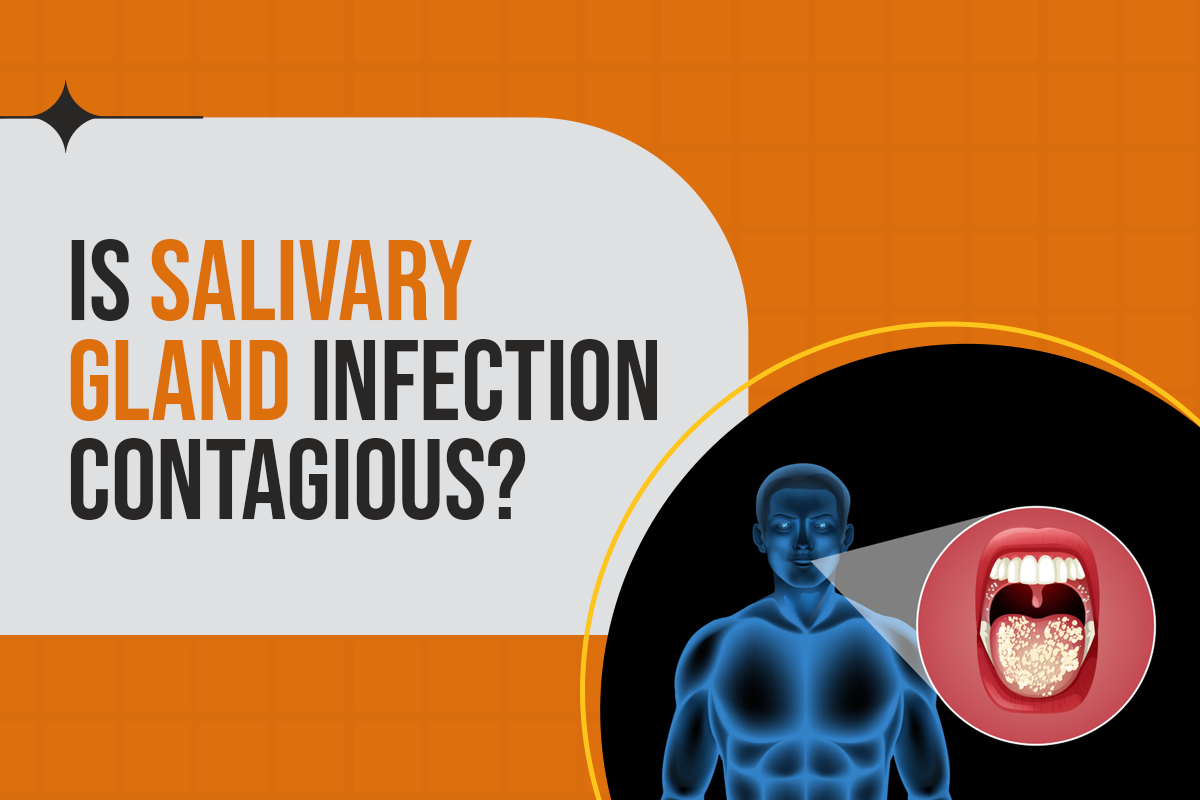 Is Salivary Gland Infection Contagious?