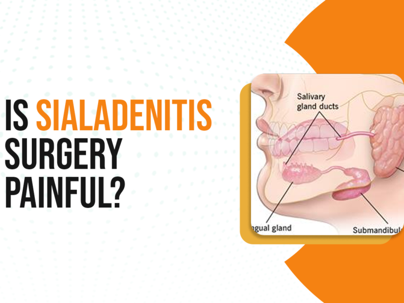 Is Sialadenitis Surgery Painful?