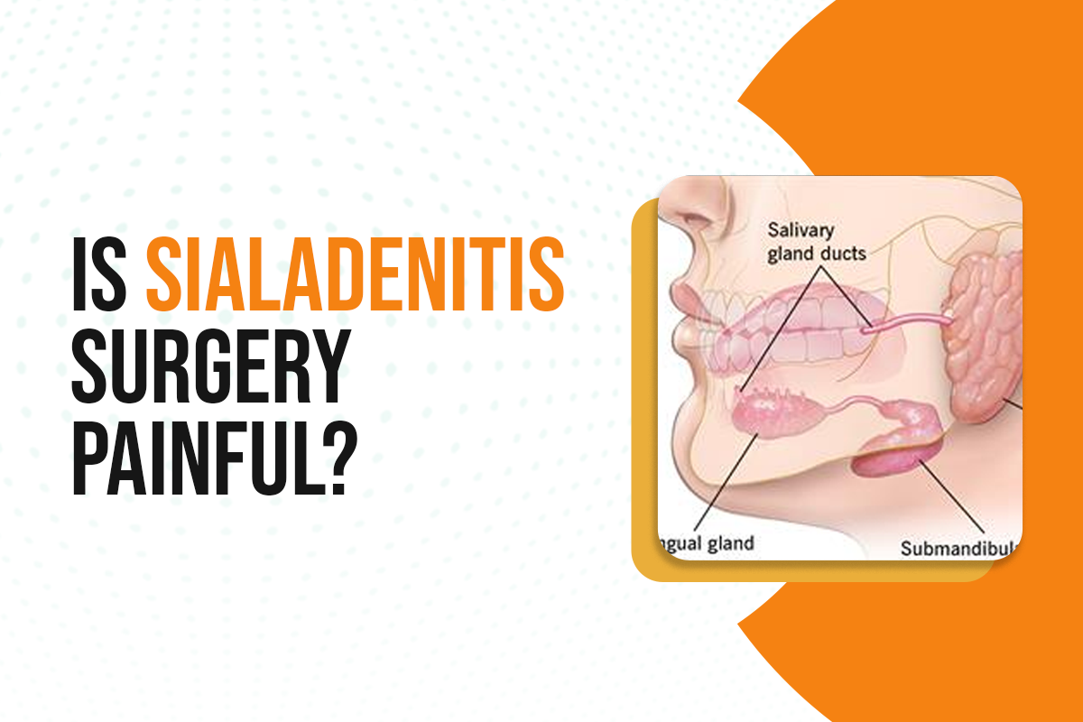 Is Sialadenitis Surgery Painful?