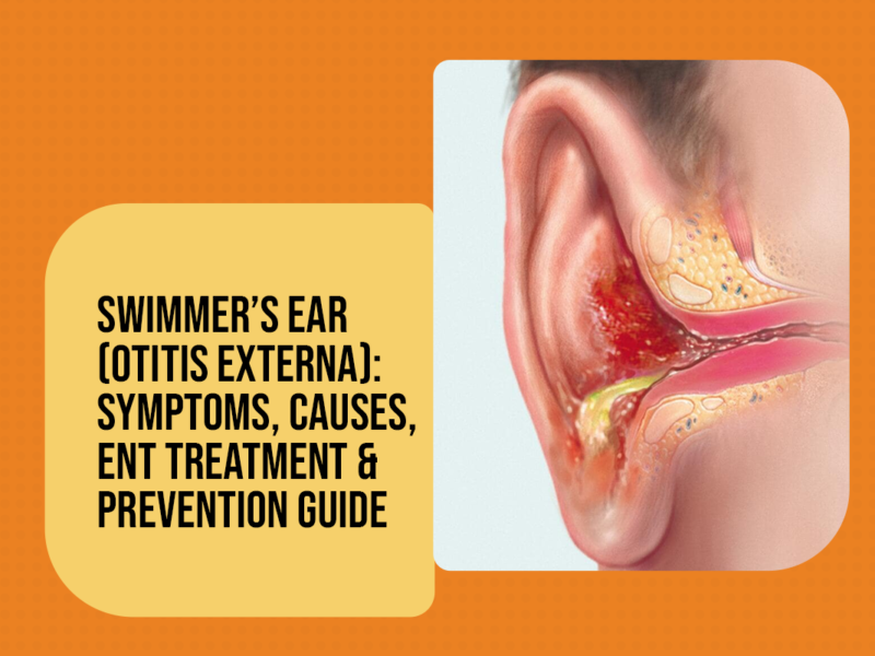 Swimmer’s Ear (Otitis Externa): Symptoms, Causes, ENT Treatment & Prevention Guide