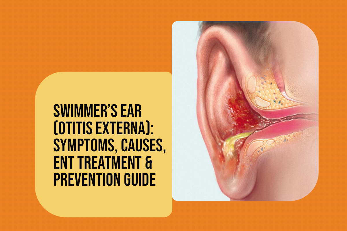 Swimmer’s Ear (Otitis Externa): Symptoms, Causes, ENT Treatment & Prevention Guide
