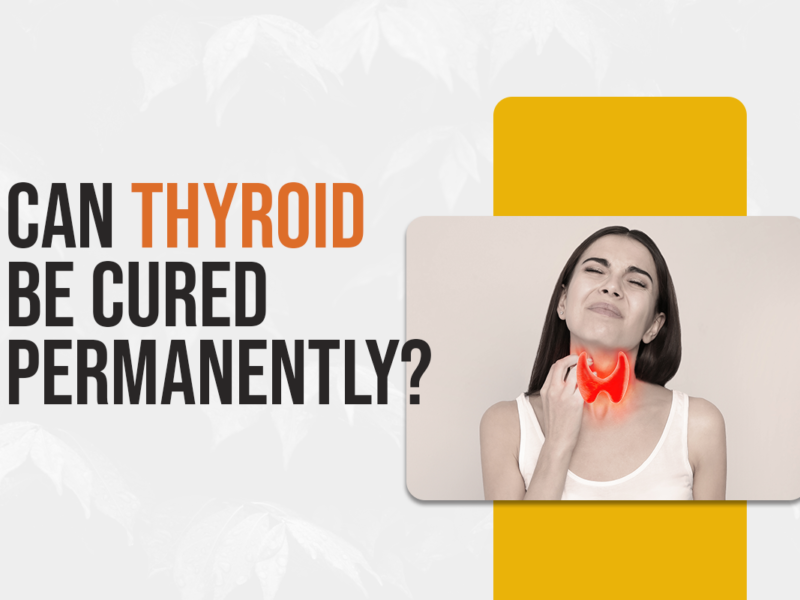 Can Thyroid Be Cured Permanently?