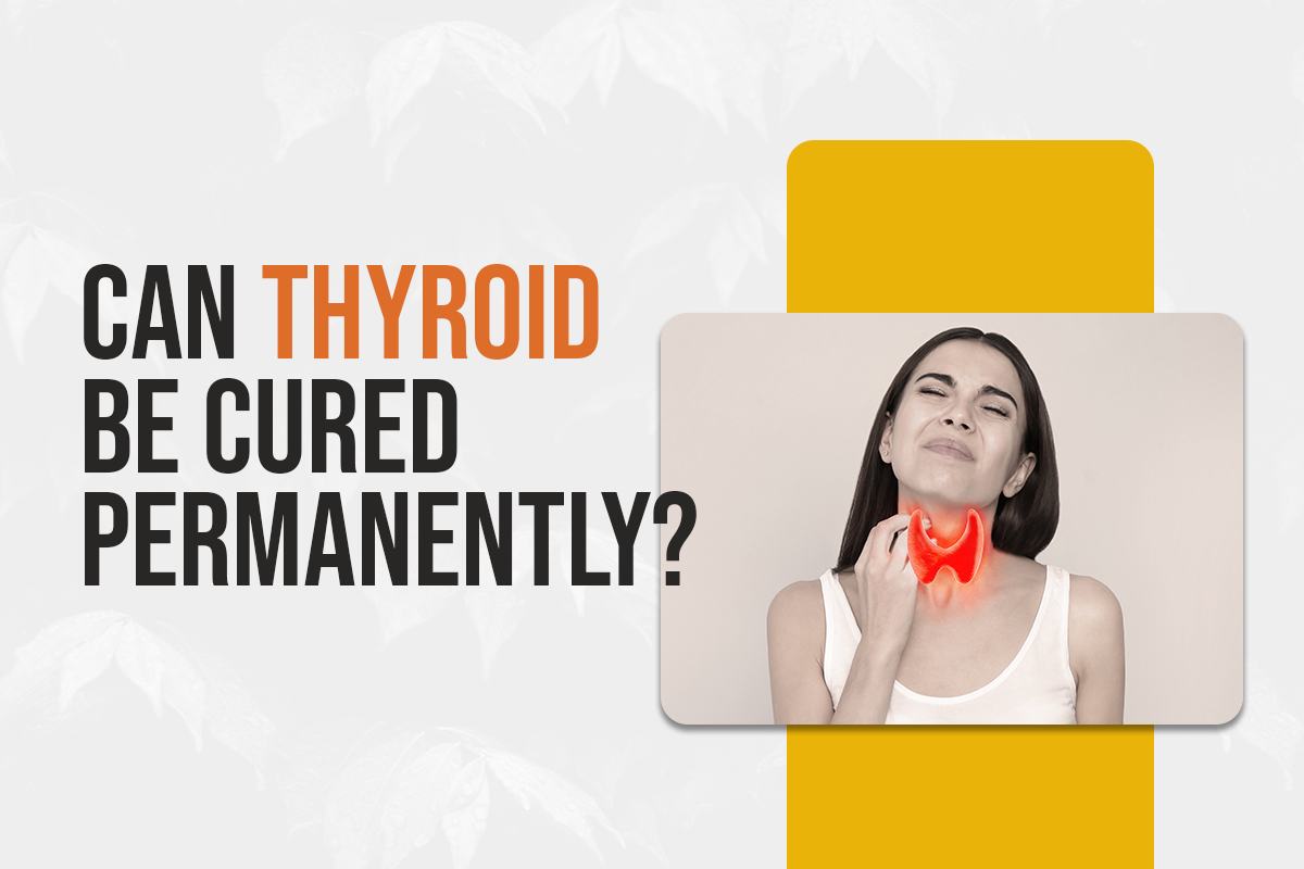 Can Thyroid Be Cured Permanently?