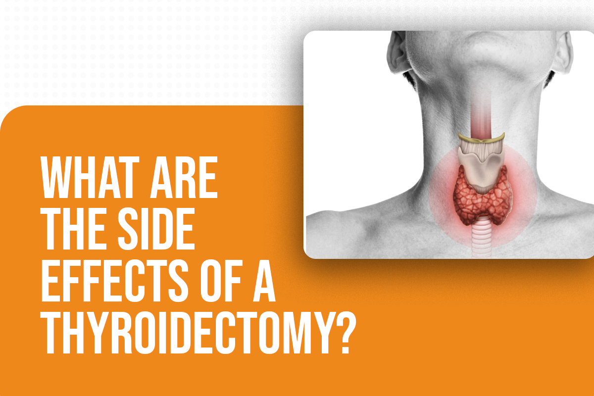 What Are the Side Effects of a Thyroidectomy?