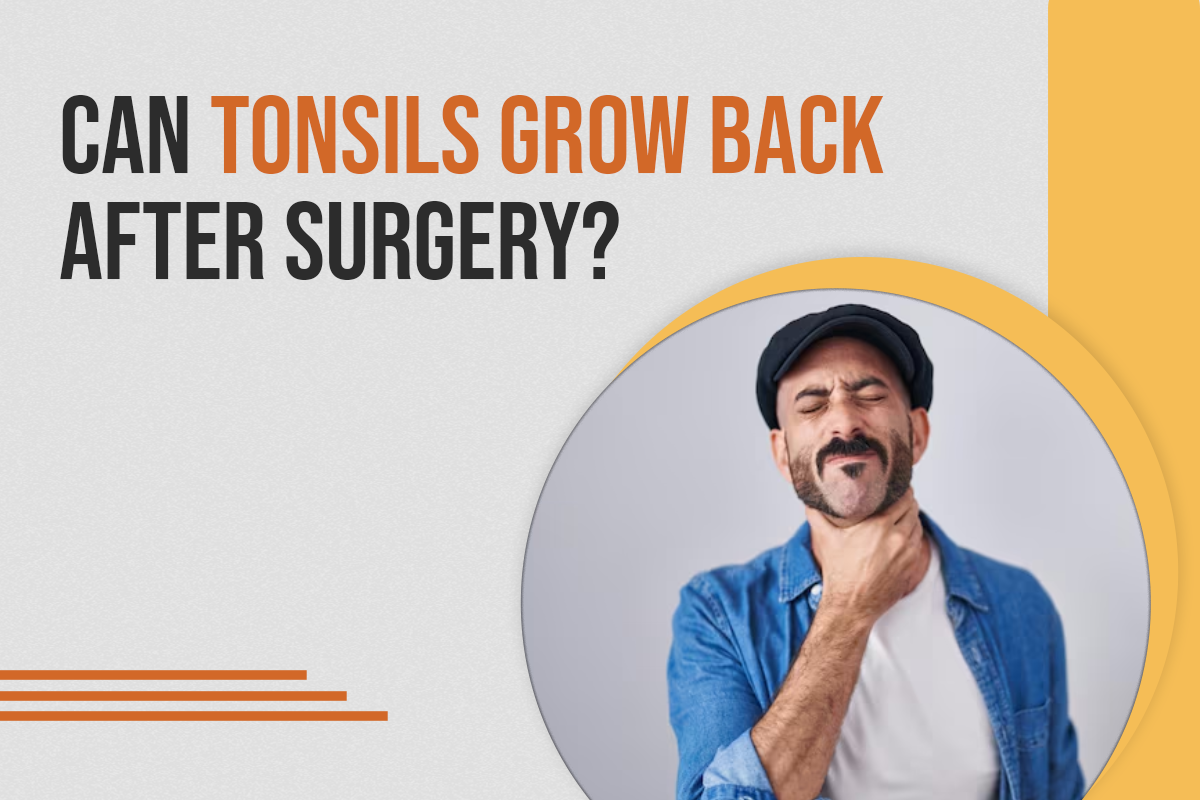 Can Tonsils Grow Back After Surgery?
